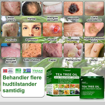 ✅Celsiora® Hudbehandlingskrem med tea tree-olje: Fjerner hudflekker, reparerer skadet hud, lysner huden og gir anti-aldring pleie ❤️‍🔥